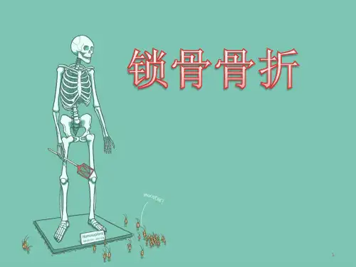 锁骨骨折PPT课件