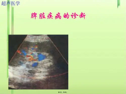 超声诊断学-3脾脏 PPT课件(共9张PPT)