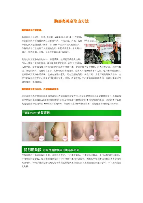 胸部奥美定取出的方法
