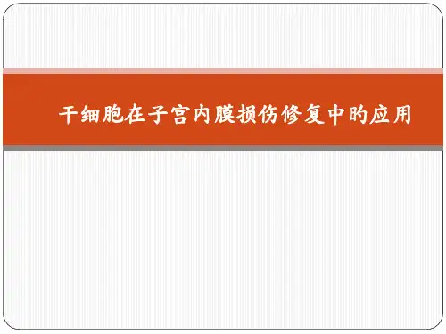 干细胞在子宫内膜损伤修复中的应用