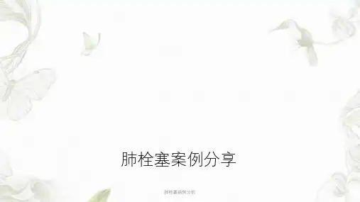 肺栓塞病例分析PPT课件