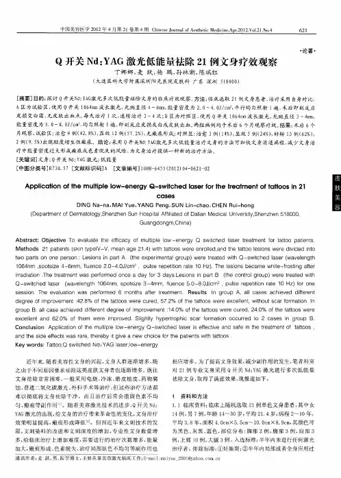 Q开关Nd：YAG激光低能量祛除21例文身疗效观察