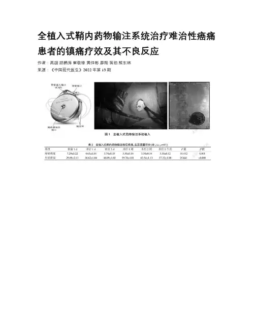 全植入式鞘内药物输注系统治疗难治性癌痛患者的镇痛疗效及其不良反应 