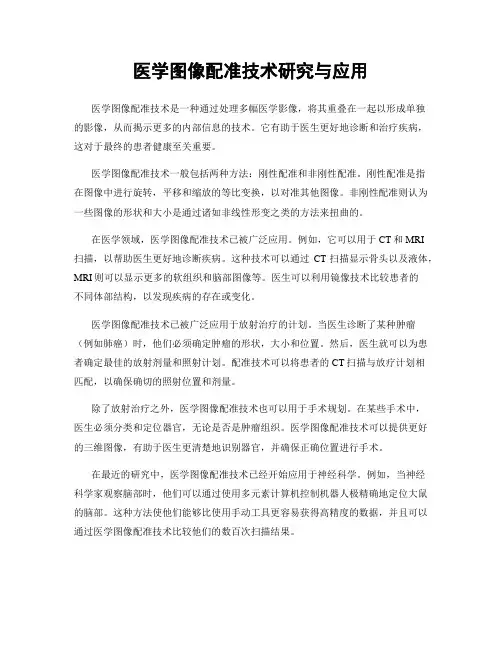 医学图像配准技术研究与应用