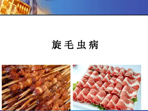 旋毛虫病(trichinelliasis )