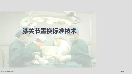 膝关节置换标准技术