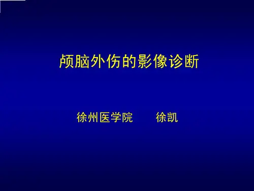 颅脑外伤的影像诊断