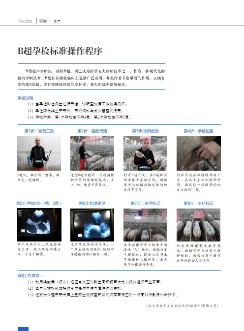 B超孕检标准操作程序
