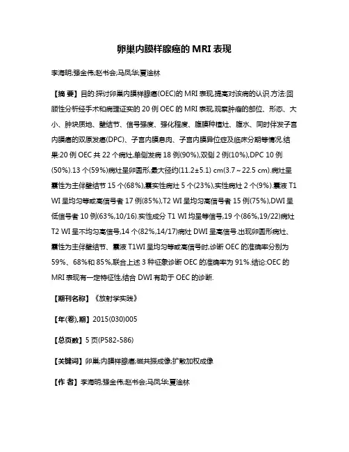 卵巢内膜样腺癌的MRI表现