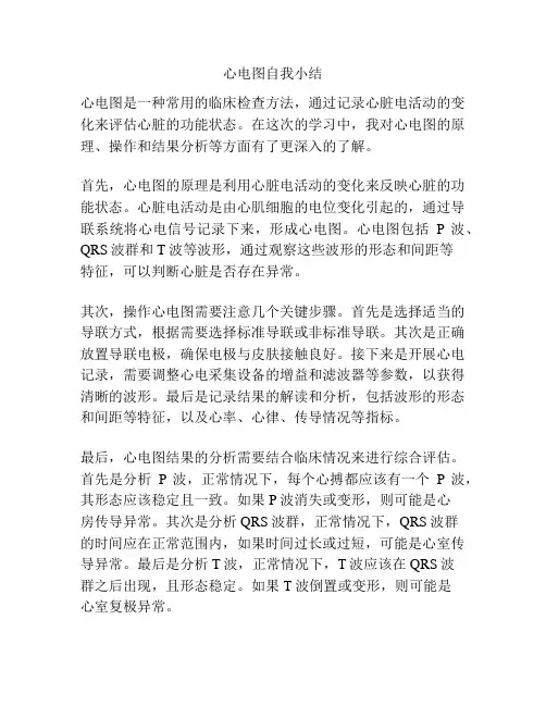 心电图自我小结