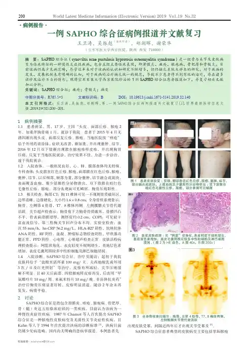 一例SAPHO综合征病例报道并文献复习