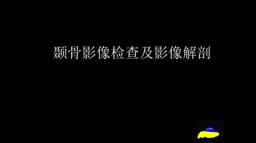 医学影像学《颞骨影像检查及影像解剖》优秀课件