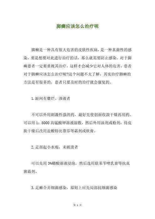 脚癣应该怎么治疗呢