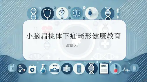 小脑扁桃体下疝畸形健康教育PPT课件