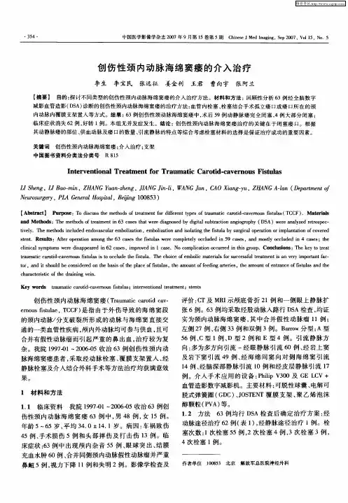 创伤性颈内动脉海绵窦瘘的介入治疗