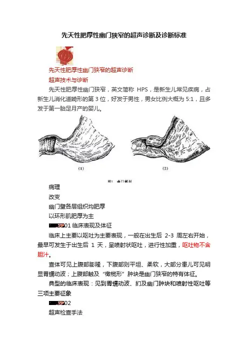 先天性肥厚性幽门狭窄的超声诊断及诊断标准