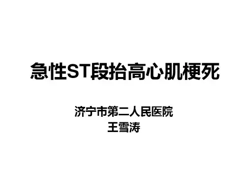 《急性心肌梗死》ppt课件
