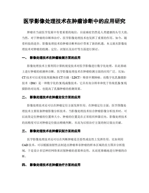 医学影像处理技术在肿瘤诊断中的应用研究
