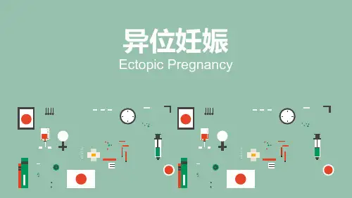 异位妊娠最新ppt课件