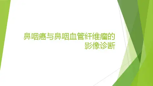 鼻咽癌与鼻咽血管纤维瘤的影像诊断-精品医学课件