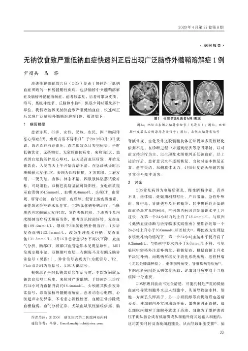无钠饮食致严重低钠血症快速纠正后出现广泛脑桥外髓鞘溶解症1例