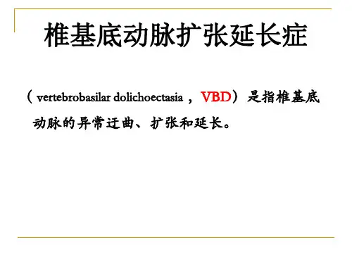 医学课件基底动脉扩张延长综合征
