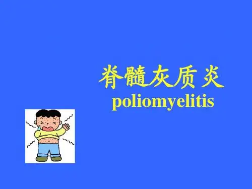 脊髓灰质炎