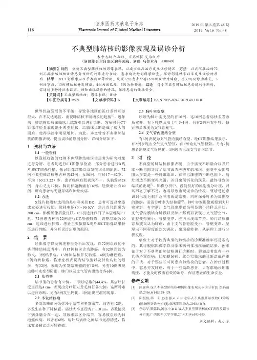 不典型肺结核的影像表现及误诊分析