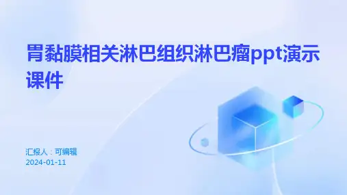 胃黏膜相关淋巴组织淋巴瘤ppt演示课件
