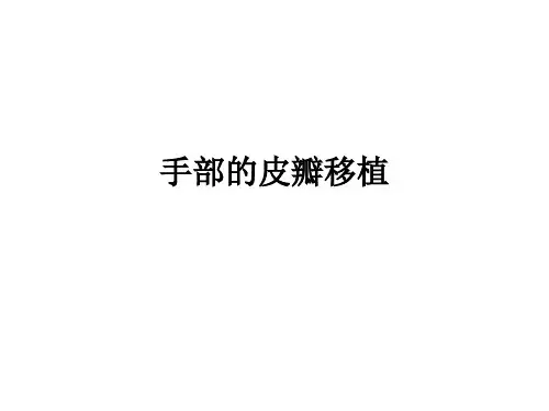 手部的皮瓣移植ppt课件
