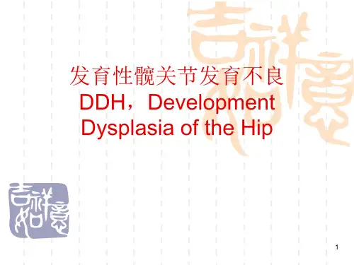 发育性髋关节发育不良DDHPPT课件