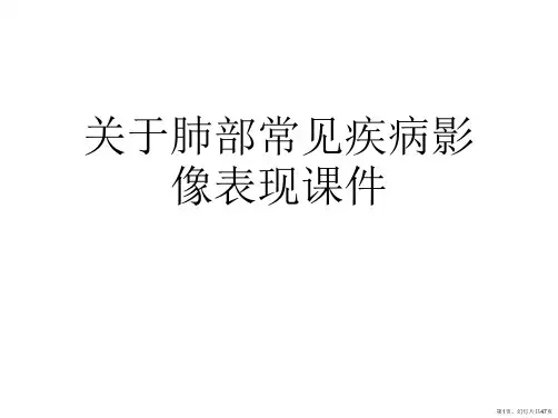 肺部常见疾病影像表现课件课件