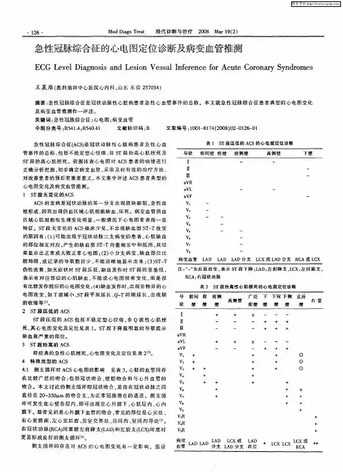 急性冠脉综合征的心电图定位诊断及病变血管推测
