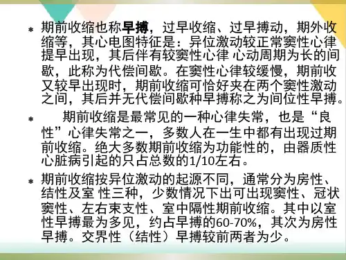 心电图系列讲座期前收缩PPT.
