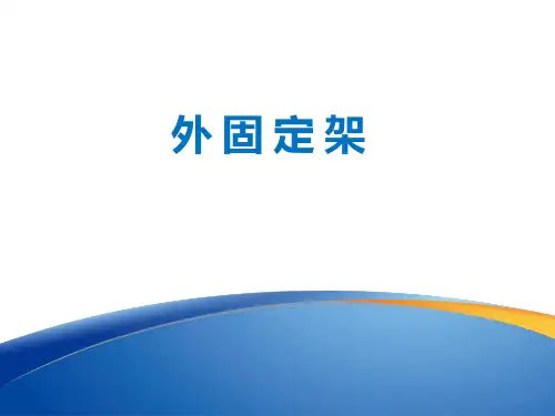 外固定架 