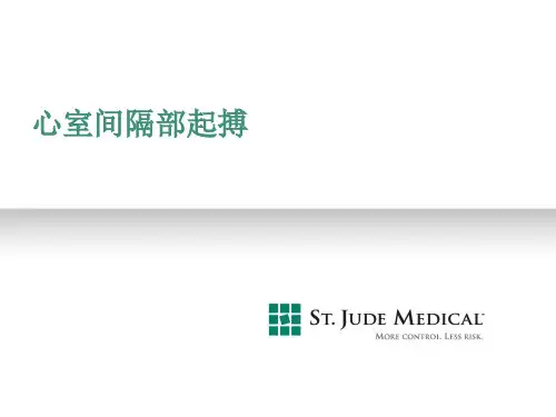 心室间隔部起搏