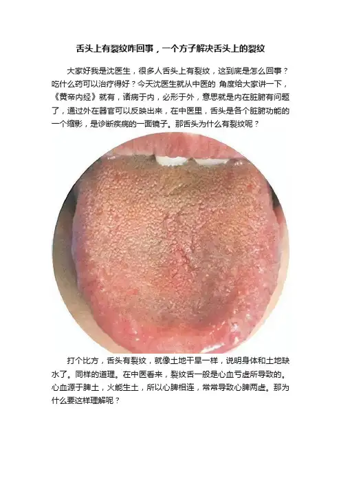 舌头上有裂纹咋回事，一个方子解决舌头上的裂纹