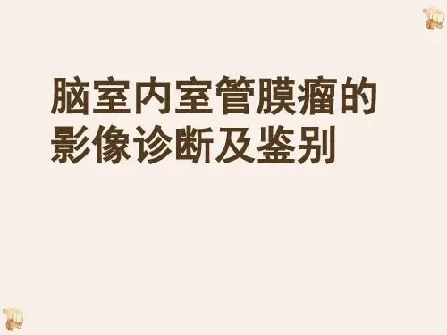 脑室内室管膜瘤的影像诊断及鉴别诊断