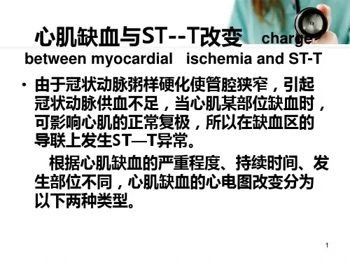 (推荐课件)心肌缺血PPT幻灯片