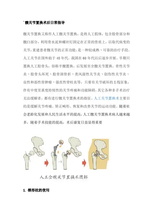 髋关节置换术后日常指导
