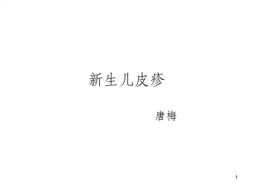 新生儿皮疹PPT课件