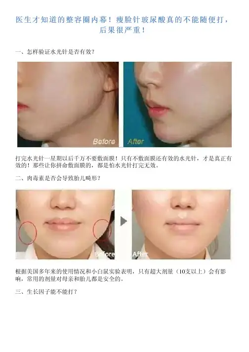 医生才知道整容圈内幕!瘦脸针玻尿酸真不能随便打,后果很严重!复习