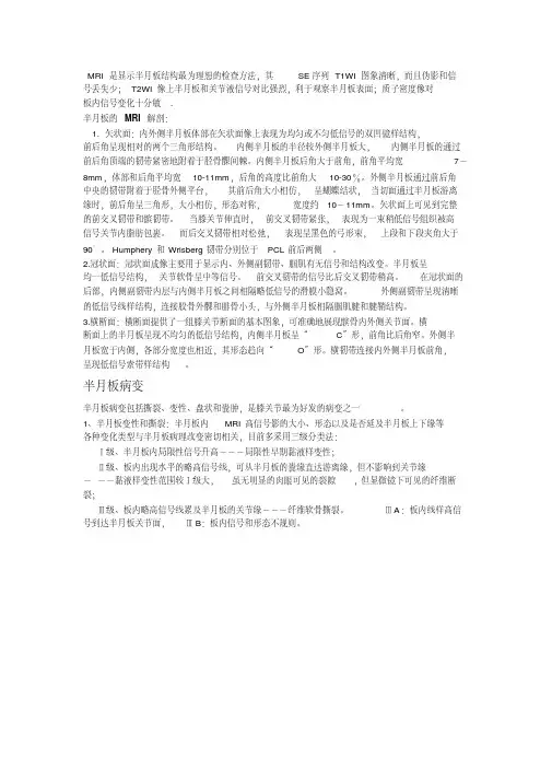 盘状半月板讲解