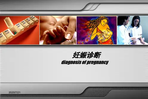 妊娠诊断ppt课件
