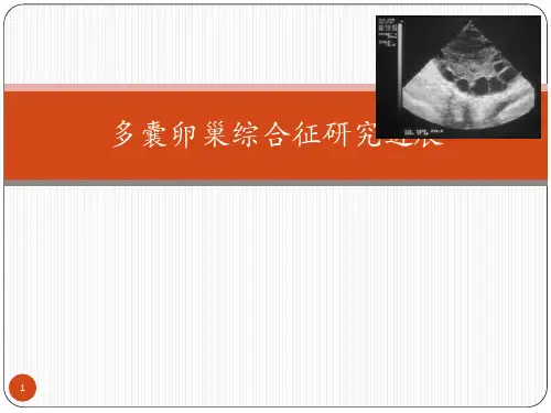 多囊卵巢综合症ppt课件