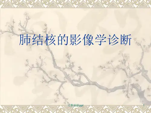 肺结核的影像学诊断完整版本