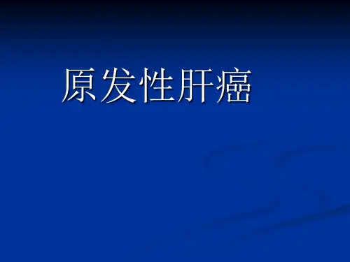 原发性肝癌