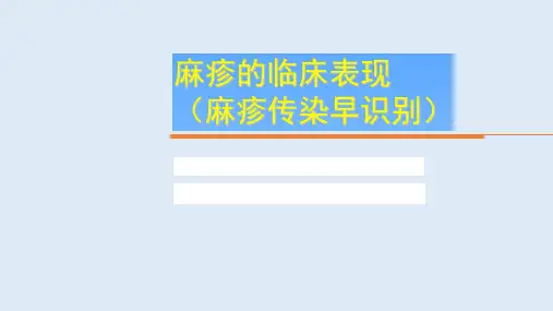 麻疹的临床表现(麻疹传染早识别)