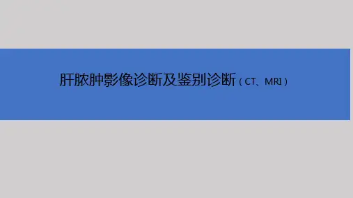 医学-肝脓肿影像诊断及鉴别诊断 ppt课件