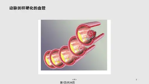 氧化应激应激PPT课件